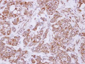 Anti-COMMD10 antibody used in IHC (Paraffin sections) (IHC-P). GTX121488