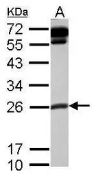 Anti-COMMD10 antibody used in Western Blot (WB). GTX121488