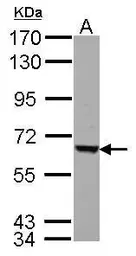 Anti-FEM1C antibody used in Western Blot (WB). GTX121493