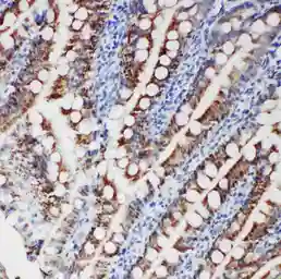 Anti-FER antibody used in IHC (Paraffin sections) (IHC-P). GTX12150