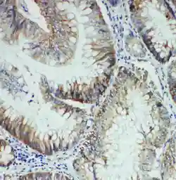 Anti-FER antibody used in IHC (Paraffin sections) (IHC-P). GTX12150