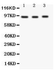 Anti-FER antibody used in Western Blot (WB). GTX12150
