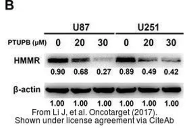 Anti-CD168 / RHAMM antibody [N1N2], N-term used in Western Blot (WB). GTX121502