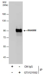 Anti-CD168 / RHAMM antibody [N1N2], N-term used in Immunoprecipitation (IP). GTX121502