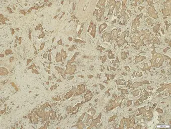 Anti-CD168 / RHAMM antibody [N1N2], N-term used in IHC (Paraffin sections) (IHC-P). GTX121502