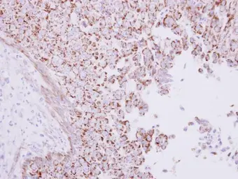 Anti-CD168 / RHAMM antibody [N1N2], N-term used in IHC (Paraffin sections) (IHC-P). GTX121502