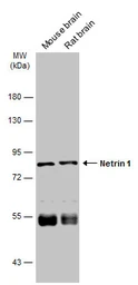 Anti-Netrin G1 ligand antibody [N1N3] used in Western Blot (WB). GTX121508