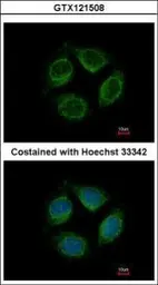 Anti-Netrin G1 ligand antibody [N1N3] used in Immunocytochemistry/ Immunofluorescence (ICC/IF). GTX121508