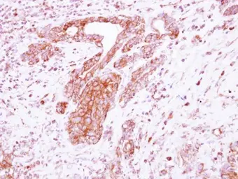 Anti-Netrin G1 ligand antibody [N1N3] used in IHC (Paraffin sections) (IHC-P). GTX121508