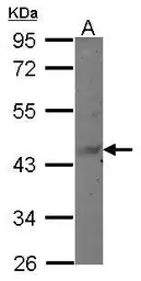 Anti-MAGEB6 antibody [N3C3] used in Western Blot (WB). GTX121509