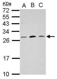 Anti-MRPL18 antibody used in Western Blot (WB). GTX121511