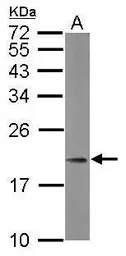 Anti-MRPL21 antibody used in Western Blot (WB). GTX121512
