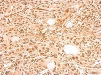 Anti-HEXIM2 antibody used in IHC (Paraffin sections) (IHC-P). GTX121524