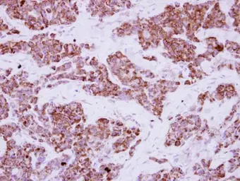 Anti-LRRC23 antibody used in IHC (Paraffin sections) (IHC-P). GTX121536