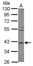 Anti-LRRC23 antibody used in Western Blot (WB). GTX121536