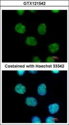 Anti-MIER3 antibody used in Immunocytochemistry/ Immunofluorescence (ICC/IF). GTX121542