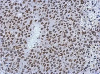 Anti-MIER3 antibody used in IHC (Paraffin sections) (IHC-P). GTX121542
