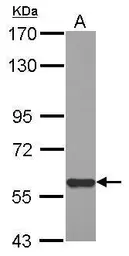 Anti-MIER3 antibody used in Western Blot (WB). GTX121542