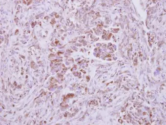 Anti-NAPRT1 antibody used in IHC (Paraffin sections) (IHC-P). GTX121545