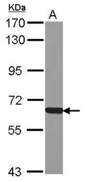 Anti-NAPRT1 antibody used in Western Blot (WB). GTX121545