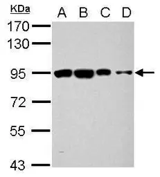 Anti-OSBPL9 antibody used in Western Blot (WB). GTX121551