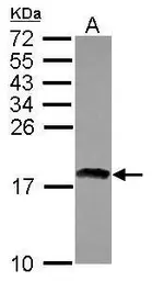 Anti-RAX2 antibody used in Western Blot (WB). GTX121564