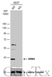 Anti-RBM4 antibody used in Western Blot (WB). GTX121565