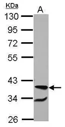 Anti-RBM4 antibody used in Western Blot (WB). GTX121565