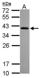 Anti-RFPL2 antibody used in Western Blot (WB). GTX121569