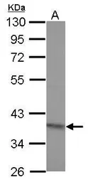 Anti-RG9MTD2 antibody used in Western Blot (WB). GTX121571