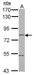 Anti-RHOBTB1 antibody used in Western Blot (WB). GTX121574