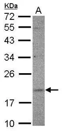 Anti-UFC1 antibody used in Western Blot (WB). GTX121605