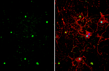 Anti-ZBTB20 antibody used in Immunocytochemistry/ Immunofluorescence (ICC/IF). GTX121616