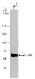 Anti-ZBTB46 antibody used in Western Blot (WB). GTX121617