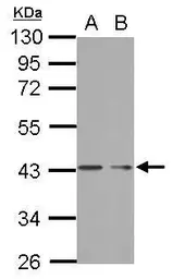 Anti-PHF7 antibody used in Western Blot (WB). GTX121618