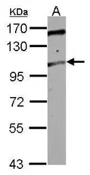 Anti-TRAK2 antibody used in Western Blot (WB). GTX121628