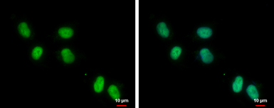 Anti-ZNF329 antibody [C1C3] used in Immunocytochemistry/ Immunofluorescence (ICC/IF). GTX121645