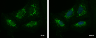 Anti-KIAA0391 antibody used in Immunocytochemistry/ Immunofluorescence (ICC/IF). GTX121658