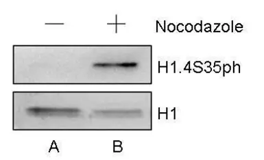Anti-Histone H1S35ph (phospho Ser35) antibody used in Western Blot (WB). GTX121669