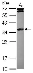 Anti-Histone H1.4 antibody [N1N2], N-term used in Western Blot (WB). GTX121670