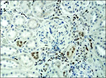 Anti-Histone H3K9acS10ph (Acetyl Lys9/phospho Ser10) antibody used in IHC (Paraffin sections) (IHC-P). GTX12181