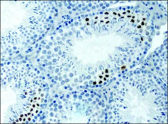 Anti-Histone H3K9acS10ph (Acetyl Lys9/phospho Ser10) antibody used in IHC (Paraffin sections) (IHC-P). GTX12181