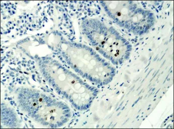 Anti-Histone H3K9acS10ph (Acetyl Lys9/phospho Ser10) antibody used in IHC (Paraffin sections) (IHC-P). GTX12181