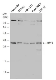 Anti-NFYB antibody used in Western Blot (WB). GTX121922