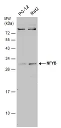 Anti-NFYB antibody used in Western Blot (WB). GTX121922