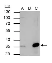 Anti-NFYB antibody used in Immunoprecipitation (IP). GTX121922