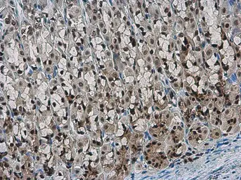 Anti-NFYB antibody used in IHC (Paraffin sections) (IHC-P). GTX121922