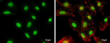 Anti-NFYB antibody used in Immunocytochemistry/ Immunofluorescence (ICC/IF). GTX121922