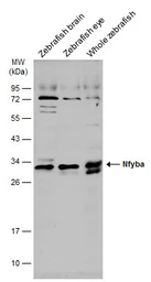 Anti-NFYB antibody used in Western Blot (WB). GTX121922