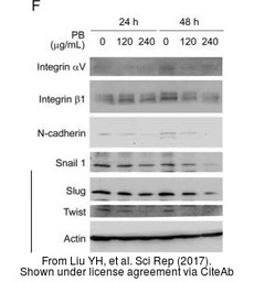 Anti-SLUG antibody used in Western Blot (WB). GTX121924